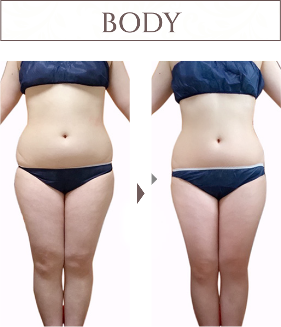 BODY