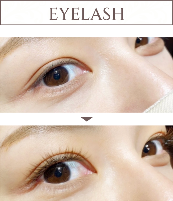 EYELASH